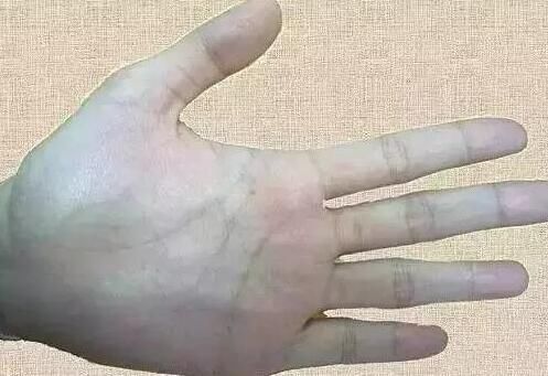 皮下脂肪|手上青筋越明显说明身体越差?今天就给大家科普一下!