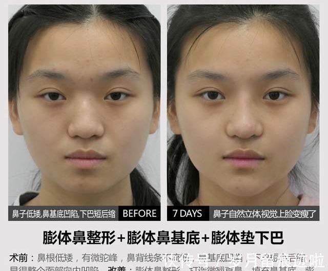 对手术 12种不适合做整形手术的行为,其中4种已被医生列入“黑名单”!