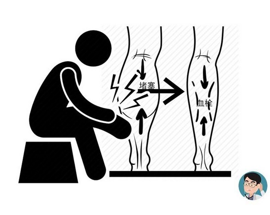 动脉|血管堵没堵,摸一摸5个部位就知道!占两个,要警惕血栓