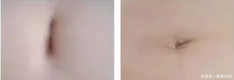 自测|五脏好不好,1分钟自测,按按肚脐就明了,早按,早受益!