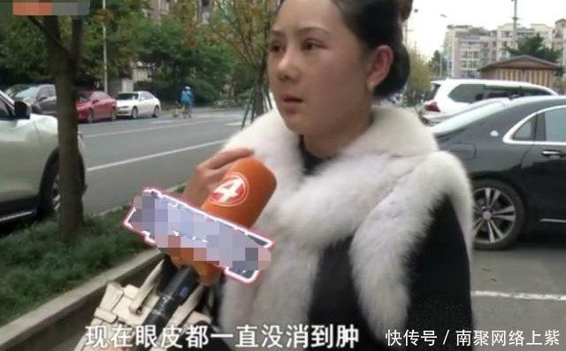 大妈|女子花9万元整容, 却脸肿脸烫的受不了, 如今完全像50岁大妈