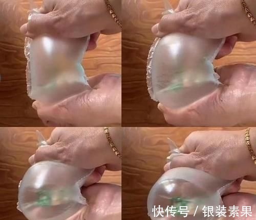 体重|“毁容式”怀孕之妊娠纹:10个孕妈9个长纹,教你咋应对咋预防