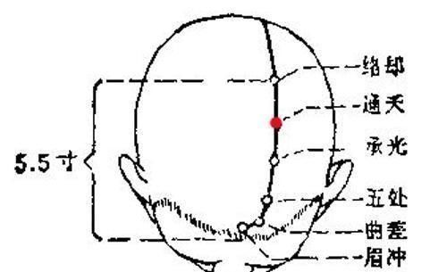 黄帝内经|5大穴位扶阳正气，再顽固的鼻炎，这样简单调理也很快痊愈了！