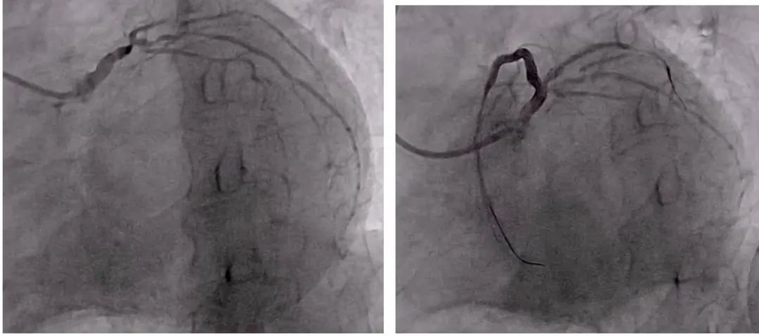 广东省第二人民医院|引以为戒！专家提醒：这种情况千万别硬扛
