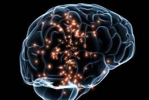 大脑|超火老年痴呆测试图,看看你能看出来几个全答对大脑不要太灵活