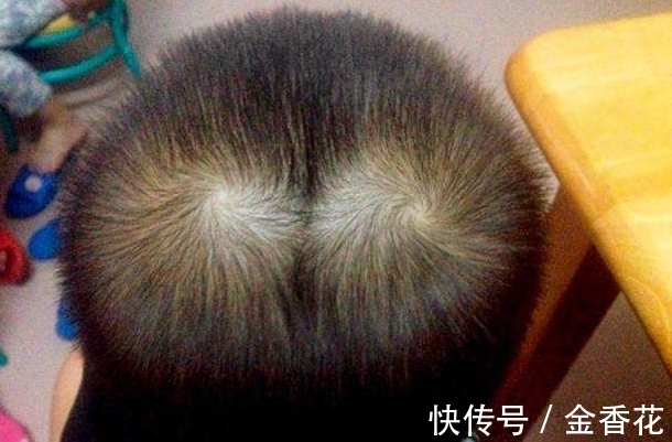波壳君|孩子头上“发旋”越多，智商就越高吗？专家研究后大开眼界！