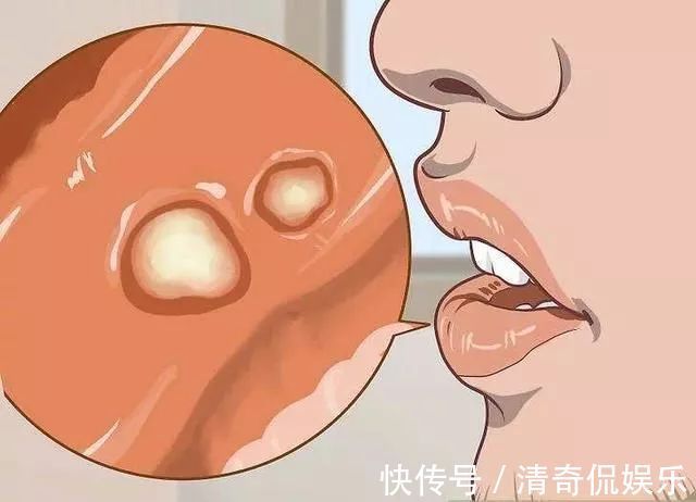 蒲公英根|春天,蒲公英,浑身是宝,对人体有4大好处,但3类人不宜吃