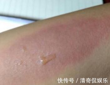 蒲公英根|春天,蒲公英,浑身是宝,对人体有4大好处,但3类人不宜吃