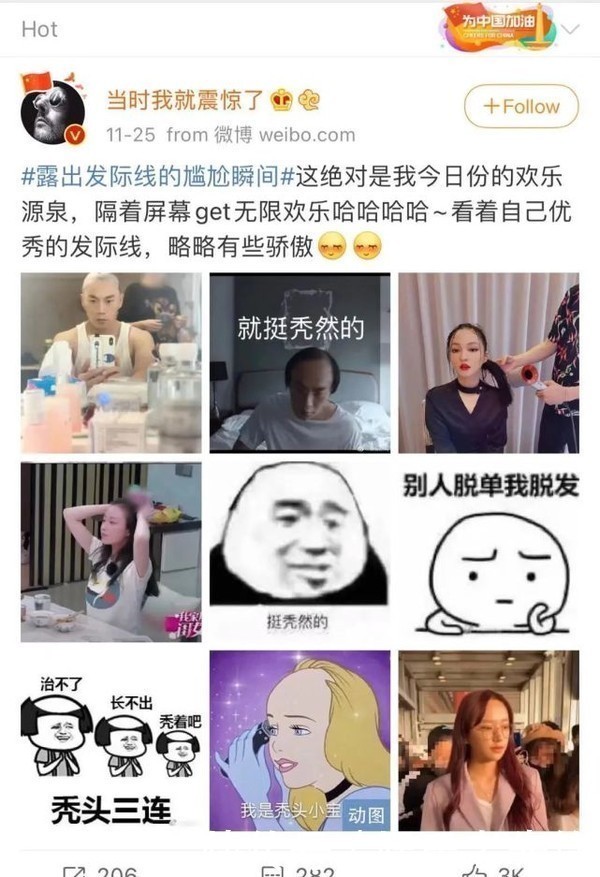 头皮|为什么别人的美人线,是你害怕露出的发际线?