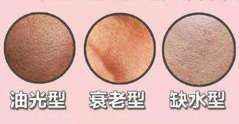 护肤品|护肤品能解决毛孔粗大问题吗?如何真正解决毛孔粗大的问题呢?