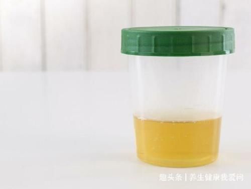 现象|出现“蛋白尿”一定是生病了吗？3类情况属于正常现象，不用担心