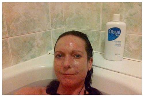 关节|“它”并不是癌症，但“它”会让人生不如死，切记要小心！