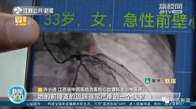 女子|13年每天20多根烟，女子突然牙疼恶心...医生一个举动救她一命