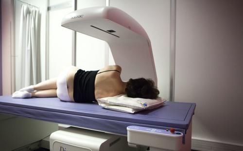 咖啡|52岁大妈严重骨质疏松,3个月后骨密度正常,看她如何做到的