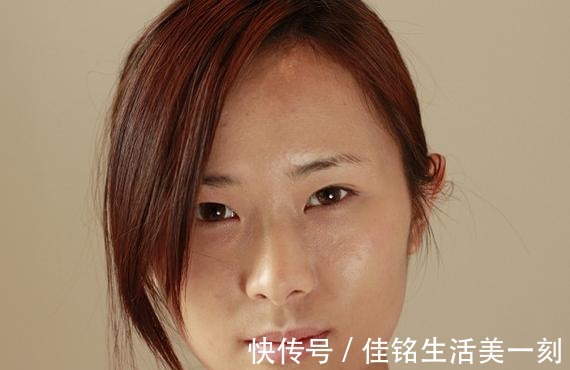 科普 其实你皮肤并不黑,只是发黄暗沉|医美科普!