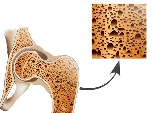 雌激素补充剂|女性快绝经时，身体或会出现6个变化，平时要细心观察，多保养