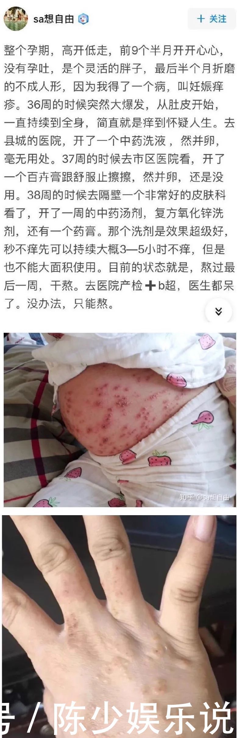 孕产妇|孕产妇蚂蚁腰,不必!