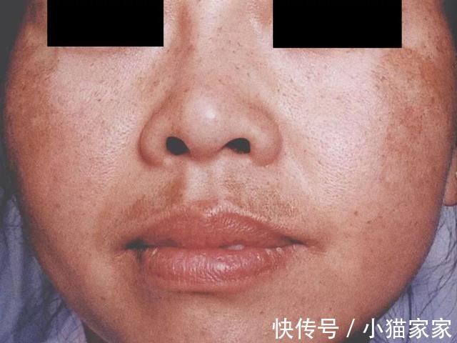 护肤品 哪些皮肤问题是护肤品不能解决的!