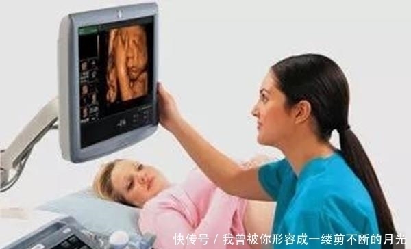 筛查|产检度过这几大关,胎儿定会健康平安,孕妇不用担心了