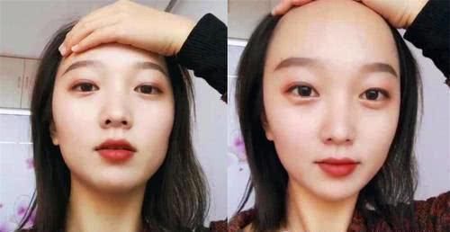 小仙女|小仙女请注意,这3种发型留久了,“发际线”会悄悄上移,特别是第三