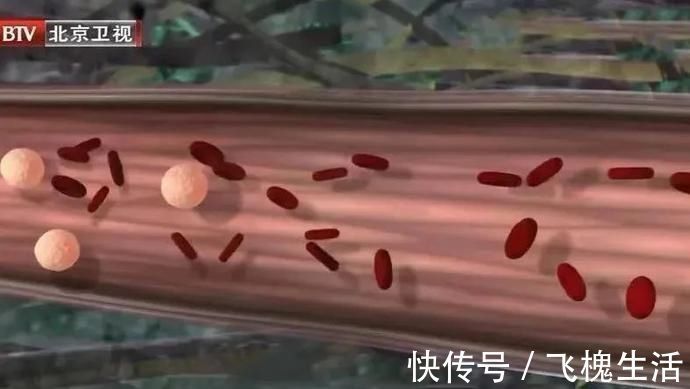 黄豆|揭开养生长寿的饮食密码!每天早上一碗它,和胃除烦、降低血脂、保护心脑血管~