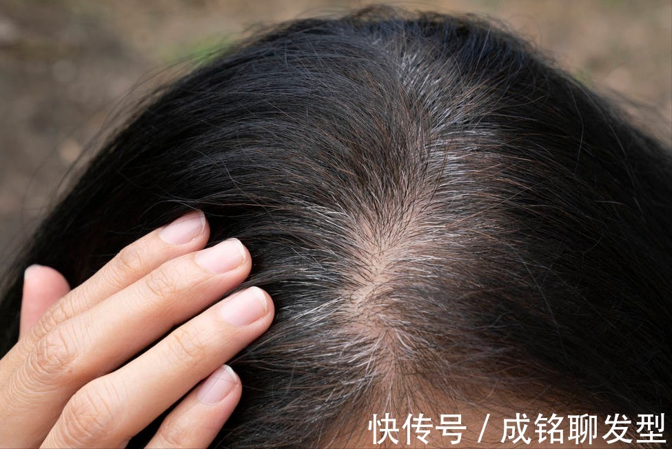 头皮|白发多也不要频繁染发,伤发又上头皮,这四个小妙招解决白发困扰