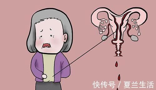 延缓衰老|女人切除子宫,和正常人有什么区别老得更快很多女人接受不了