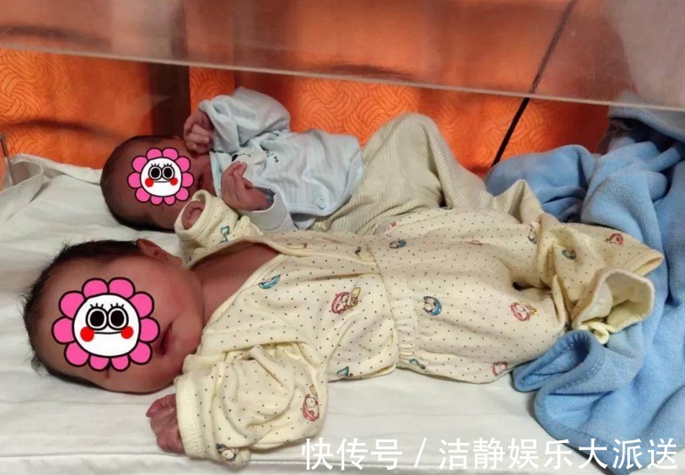 文章|孕妇怀连体婴拒绝引产,宝宝出生后,整个医院都沸腾了