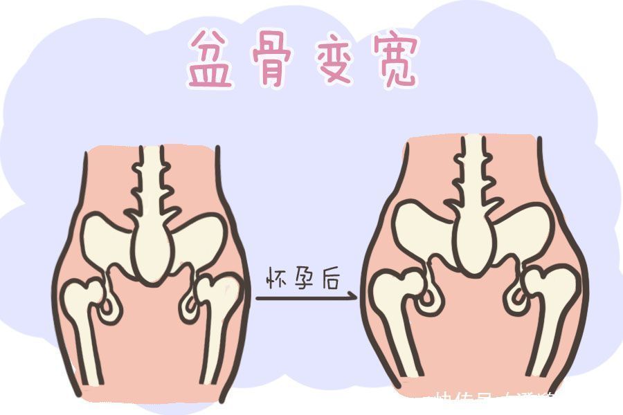 产后胯变宽了，做骨盆修复就能好大错特错，这只不过是一场骗局