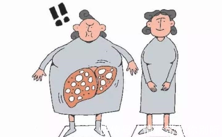 优质蛋白|为什么一直吃素还得脂肪肝?专家提醒:脂肪肝最怕的,不是脂肪!