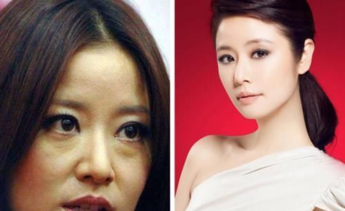 皮肤|关于“长期化妆”和“长期素颜”对皮肤的伤害,明星也是如此