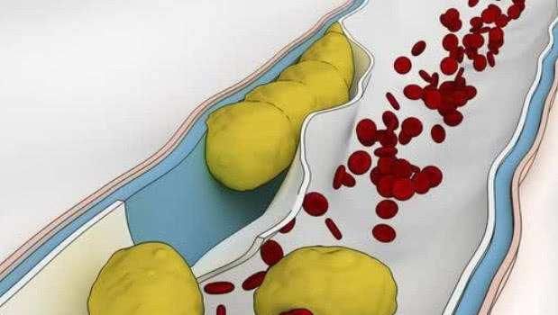  三酯指标|他106岁了，甘油三酯却一直保持在1.7以下！3个习惯不妨学学！