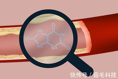 豆制品|豆制品是高嘌呤食物,痛风患者不能吃?痛风患者需忌口哪些食物?