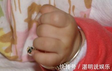 小编|3个月孩子手掌面临截肢，医生取出的东西，宝妈气的手抖