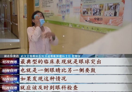 李女士|女子眼睛鼓得像鸡蛋，竟是因为这种病