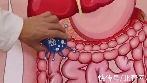 本草纲目|1/6的癌症都是炎症引起的！4类“促炎”饮食，让身体炎症越来越高发！别再吃错了