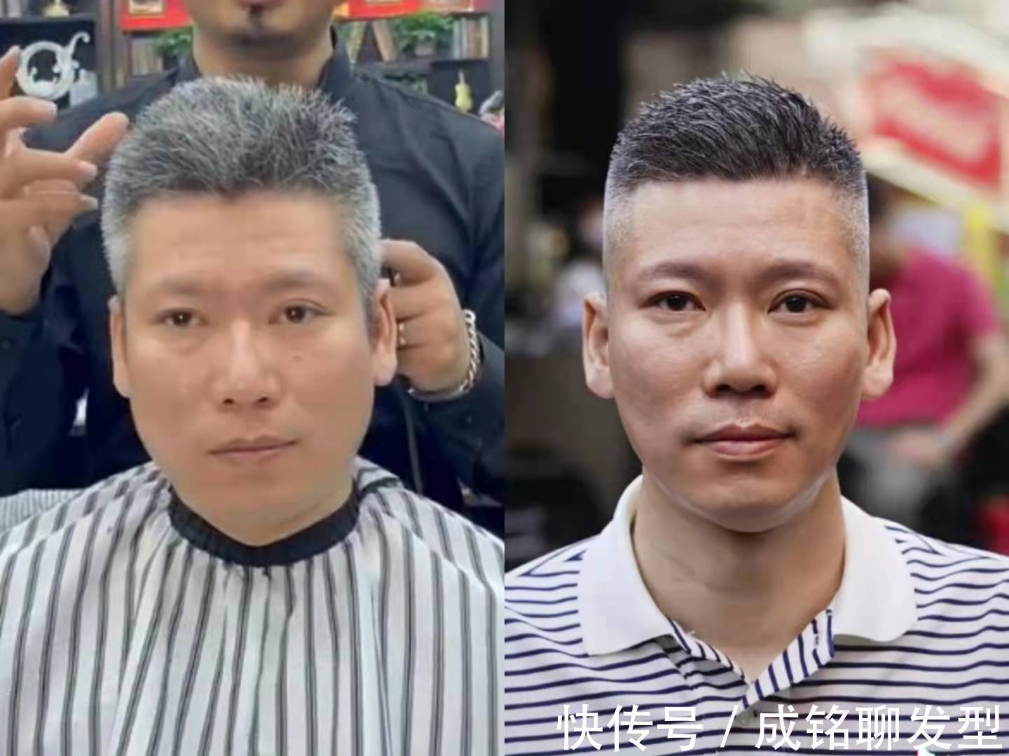 假发片 40岁头顶的头发都白了,不想染发,有啥好办法让白发变黑发吗?