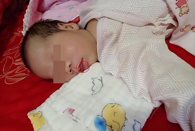 食物过敏|五个月女婴双肾长满结石,只因刚出生三天,父母就开始做这件事