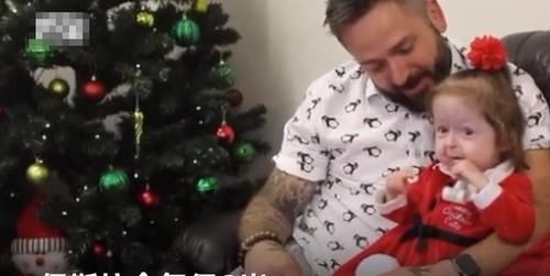 疾病|全球首例!2岁女童却有80岁的脸,网友:希望能像本杰明巴顿一样