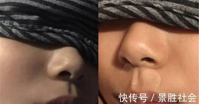 儿子|儿子越长越像“大猩猩”,宝妈调侃长残了,朋友提醒才去医院检查