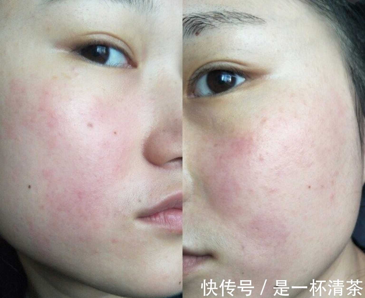 女人 脸上有这四个特征的女人,用护肤品易“烂脸”,中三个以上快停用