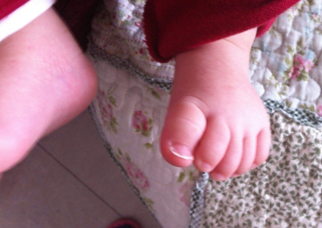 鞋子|3岁宝宝双脚变形,就是因为长时间穿这种鞋子,家长要重视了!