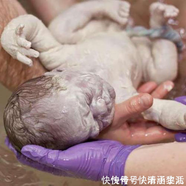 绒毛|宝妈吐槽自己生了一颗“猕猴桃”,晒出宝宝照片后,网友恍然大悟