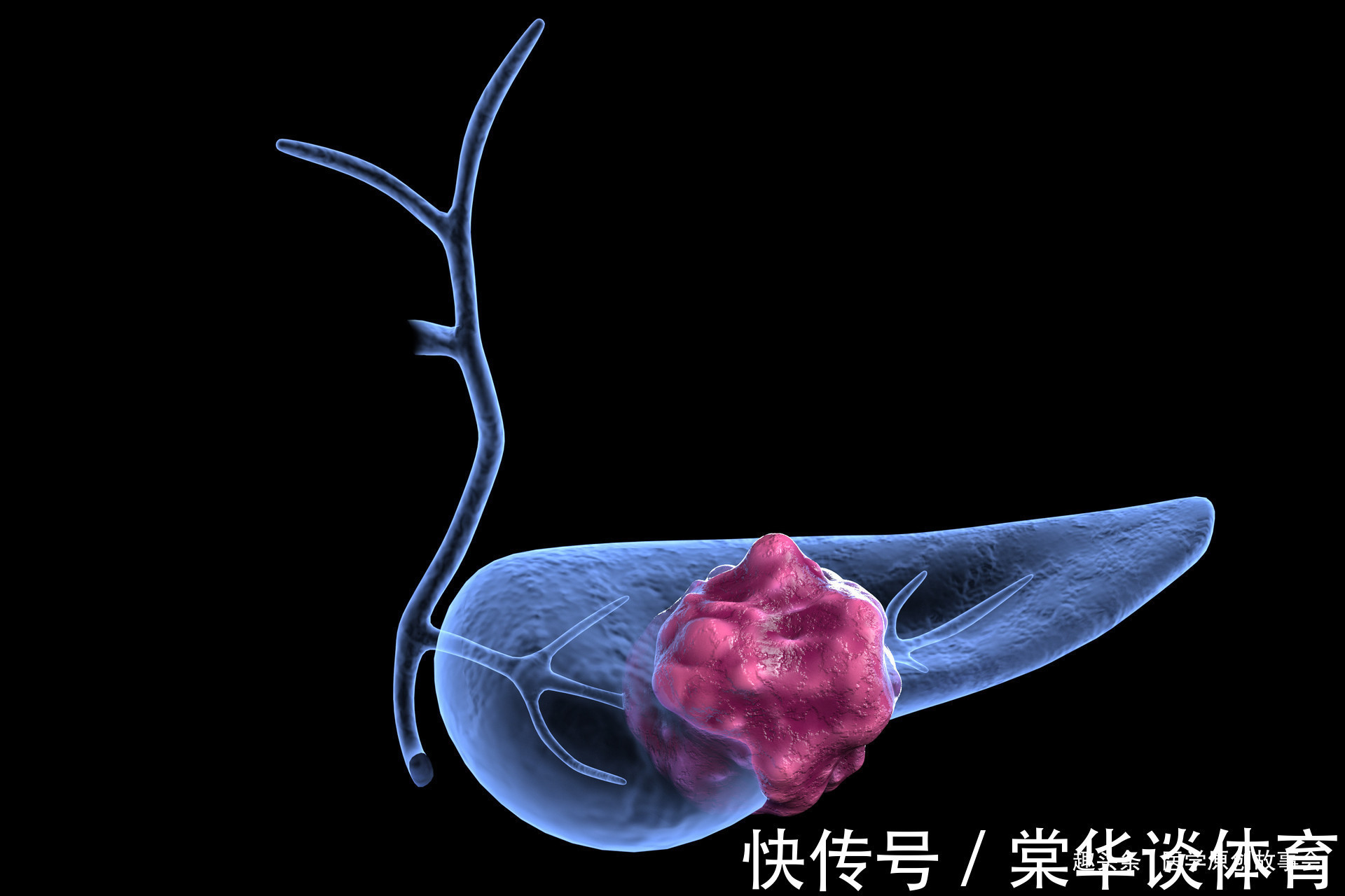 体检|体检不做四个检查，得了癌症却不知道，四个部位建议三年体检一次