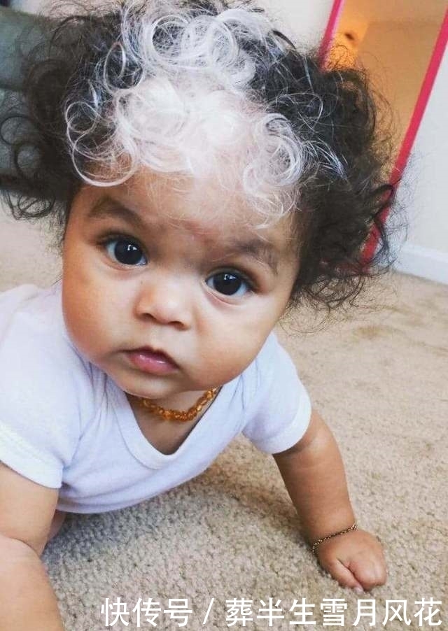 医生|婴儿刚出生就满头白发，医生说这几率太低了，长大没想到这么好看
