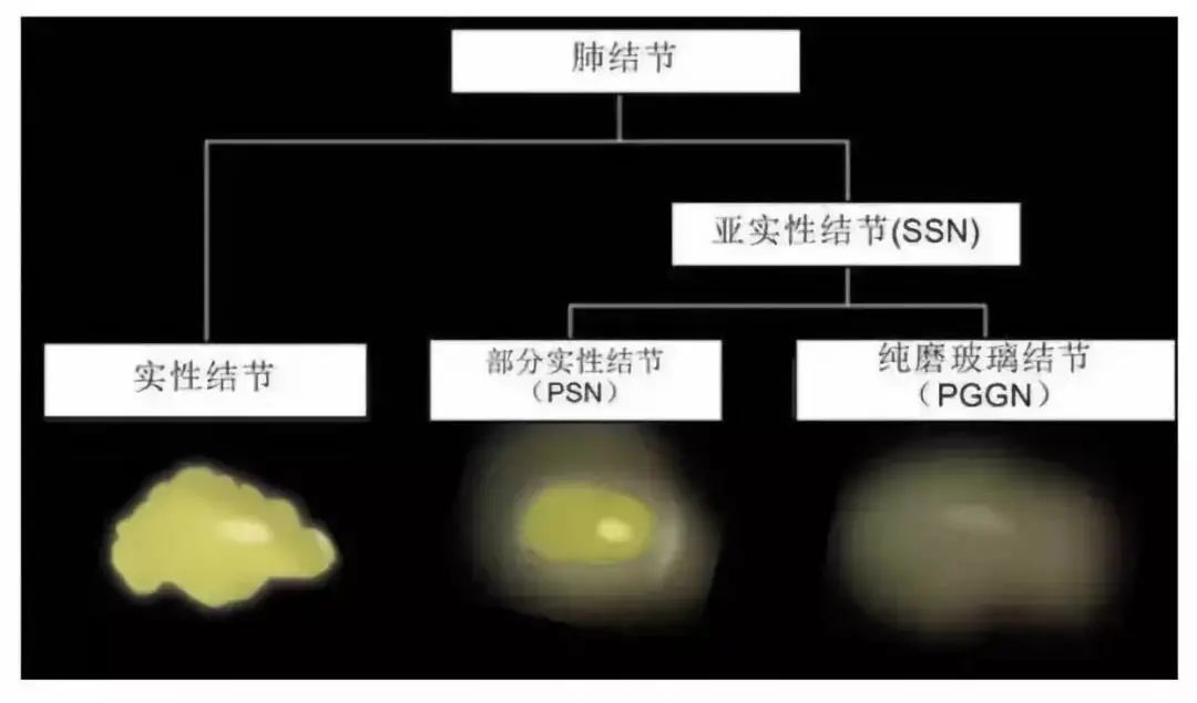 小结节|【健康知识】 肺小结节，那些你不可不知的“秘密”