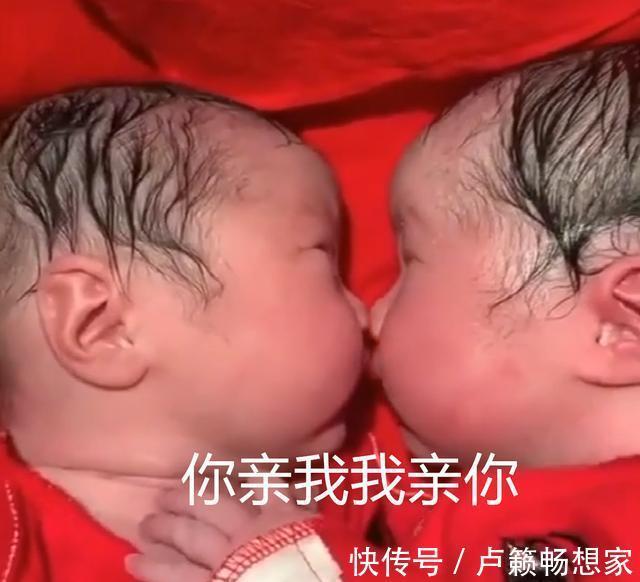 宝宝|刚出生的龙凤胎就一直亲,护士都分不开,画面实在太暖心了