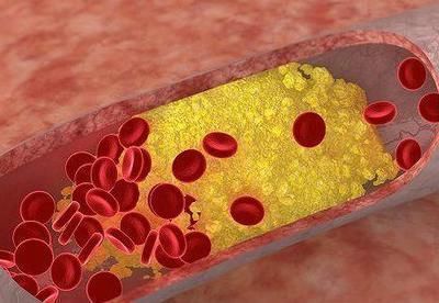 长寿|寿命长不长，身体3出有无“异常”，若你一个也没有恭喜你长寿