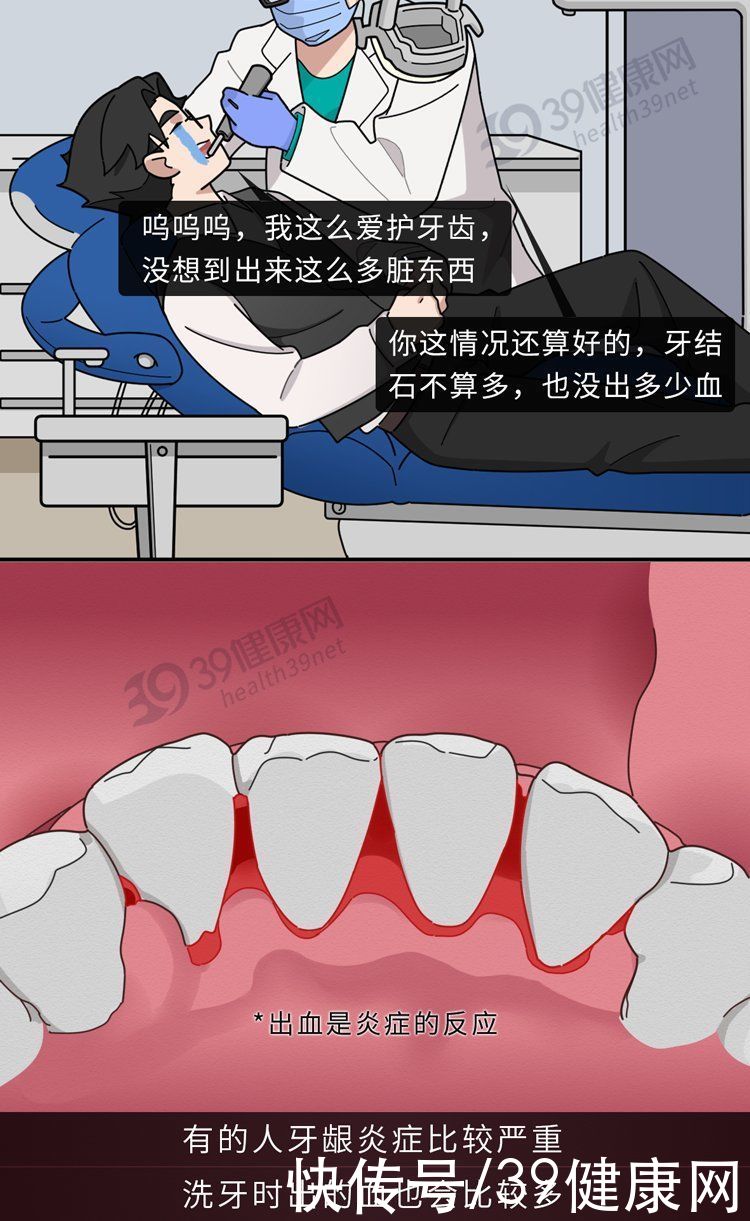 中华|不洗牙，你永远不知道牙齿里面有多脏！看完这篇就拿定主意了