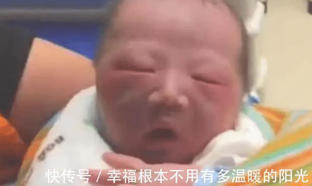 胎脂|新生儿因太“丑”遭全家嫌弃,医生却说很好看,满月后见分晓